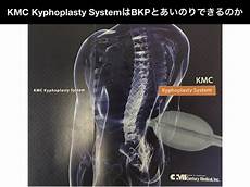 Kyphoplasty System