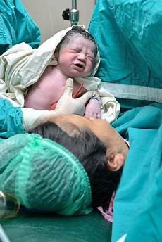 Baby Feeding