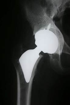Ceramic Joint