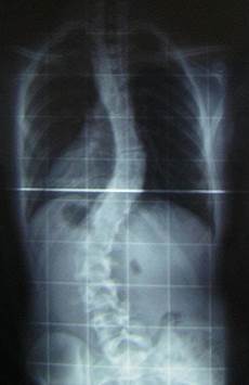 Diagnostic