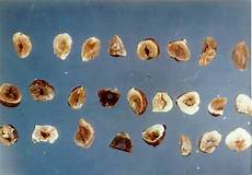 Hazelnut Kernel