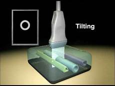 Medical Probe