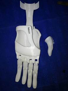 Medical Prosthesis
