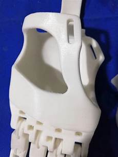 Medical Prosthesis