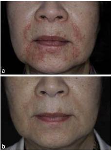 Medical Serum