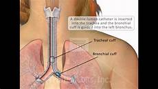 Medical Tubes