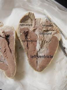Medical Valve