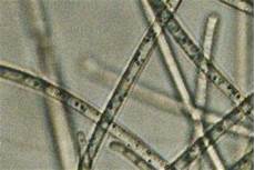 Microbial