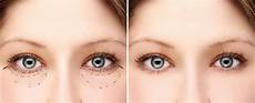 Reconstructive Creams