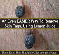 Vinegar